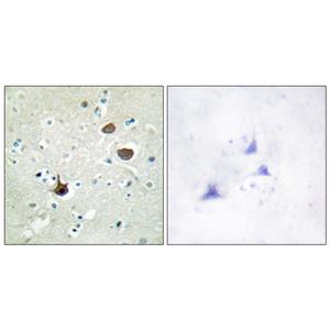 Fusin (phospho Ser339)兔多抗,Fusin (phospho Ser339) Rabbit Polyclonal Antibody