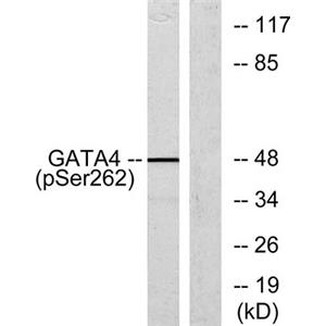 GATA-4 (phospho Ser262)兔多抗,GATA-4 (phospho Ser262) Rabbit Polyclonal Antibody