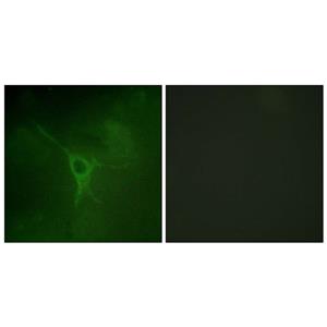 GFAP (phospho Ser38)兔多抗,GFAP (phospho Ser38) Rabbit Polyclonal Antibody