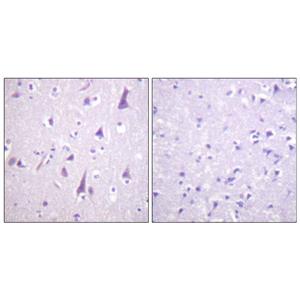 GFAP (phospho Ser38)兔多抗,GFAP (phospho Ser38) Rabbit Polyclonal Antibody