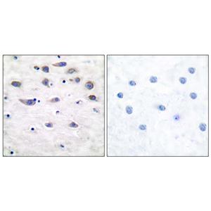 GluR-1 (phospho Ser849)兔多抗,GluR-1 (phospho Ser849) Rabbit Polyclonal Antibody