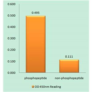 Glycogen Synthase 1 (phospho Ser645)兔多抗,Glycogen Synthase 1 (phospho Ser645) Rabbit Polyclonal Antibody