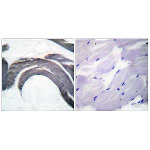 Glycogen Synthase 1 (phospho Ser645)兔多抗,Glycogen Synthase 1 (phospho Ser645) Rabbit Polyclonal Antibody