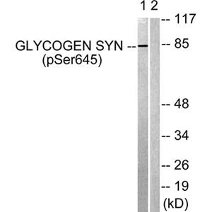 Glycogen Synthase 1 (phospho Ser645)兔多抗,Glycogen Synthase 1 (phospho Ser645) Rabbit Polyclonal Antibody