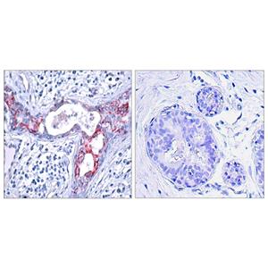 GSK3β (phospho Ser9)兔多抗,GSK3β (phospho Ser9) Rabbit Polyclonal Antibody