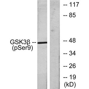 GSK3β (phospho Ser9)兔多抗,GSK3β (phospho Ser9) Rabbit Polyclonal Antibody
