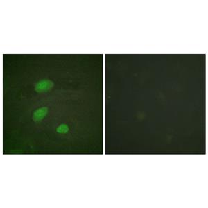HIRA (phospho Thr555)兔多抗,HIRA (phospho Thr555) Rabbit Polyclonal Antibody