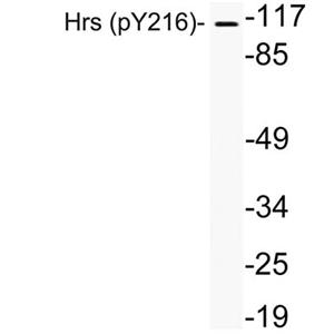 Hrs (phospho Tyr216)兔多抗,Hrs (phospho Tyr216) Rabbit Polyclonal Antibody