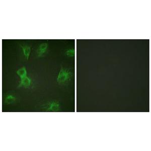Hrs (phospho Tyr334)兔多抗,Hrs (phospho Tyr334) Rabbit Polyclonal Antibody