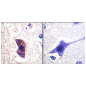 Hrs (phospho Tyr334)兔多抗,Hrs (phospho Tyr334) Rabbit Polyclonal Antibody