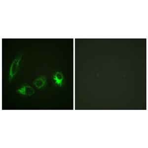 IRS-1 (phospho Ser323)兔多抗,IRS-1 (phospho Ser323) Rabbit Polyclonal Antibody