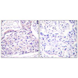 IRS-1 (phospho Ser323)兔多抗,IRS-1 (phospho Ser323) Rabbit Polyclonal Antibody