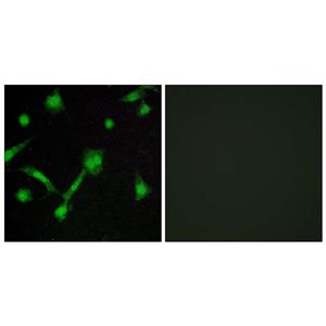 IκB-α (phospho Ser32/S36)兔多抗,IκB-α (phospho Ser32/S36) Rabbit Polyclonal Antibody