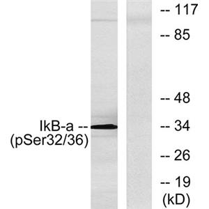 IκB-α (phospho Ser32/S36)兔多抗,IκB-α (phospho Ser32/S36) Rabbit Polyclonal Antibody