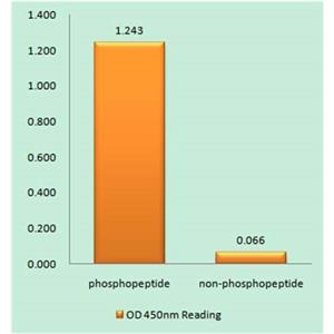 IκB-β (phospho Ser23)兔多抗,IκB-β (phospho Ser23) Rabbit Polyclonal Antibody