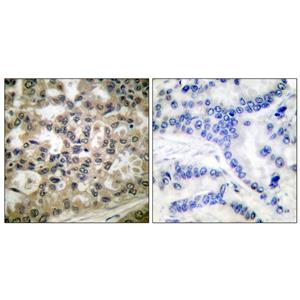 IκB-β (phospho Ser23)兔多抗,IκB-β (phospho Ser23) Rabbit Polyclonal Antibody