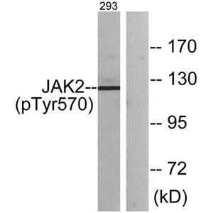 JAK2 (phospho Tyr570)兔多抗,JAK2 (phospho Tyr570) Rabbit Polyclonal Antibody