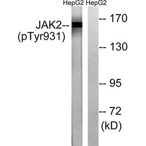 JAK2 (phospho Tyr931)兔多抗,JAK2 (phospho Tyr931) Rabbit Polyclonal Antibody