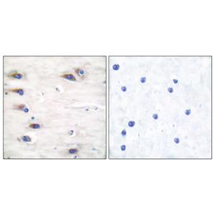 Ksr-1 (phospho Ser392)兔多抗,Ksr-1 (phospho Ser392) Rabbit Polyclonal Antibody