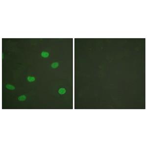 Lamin A/C (phospho Ser392)兔多抗,Lamin A/C (phospho Ser392) Rabbit Polyclonal Antibody
