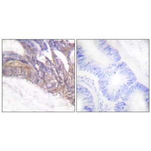 LAT (phospho Tyr191)兔多抗,LAT (phospho Tyr191) Rabbit Polyclonal Antibody