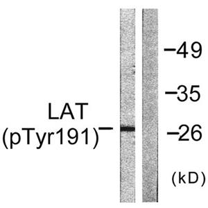 LAT (phospho Tyr191)兔多抗,LAT (phospho Tyr191) Rabbit Polyclonal Antibody
