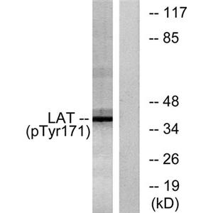 LAT (phospho Tyr200)兔多抗,LAT (phospho Tyr200) Rabbit Polyclonal Antibody