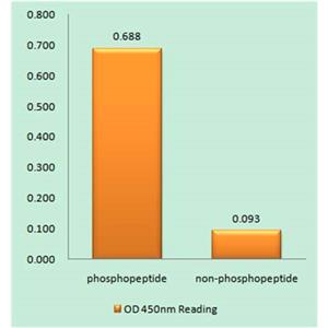 Lck (phospho Tyr192)兔多抗,Lck (phospho Tyr192) Rabbit Polyclonal Antibody
