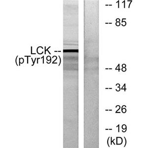 Lck (phospho Tyr192)兔多抗,Lck (phospho Tyr192) Rabbit Polyclonal Antibody