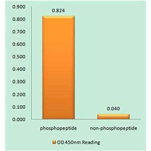 Lck (phospho Tyr505)兔多抗,Lck (phospho Tyr505) Rabbit Polyclonal Antibody