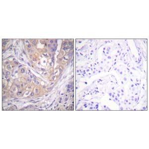 Lck (phospho Tyr505)兔多抗,Lck (phospho Tyr505) Rabbit Polyclonal Antibody
