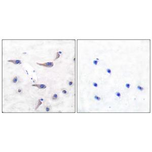 MARCKS (phospho Ser163)兔多抗,MARCKS (phospho Ser163) Rabbit Polyclonal Antibody