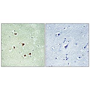 Max (phospho Ser2)兔多抗,Max (phospho Ser2) Rabbit Polyclonal Antibody