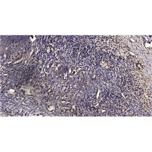 Mcl-1 (phospho-Thr163) 兔多抗,Mcl-1 (phospho-Thr163)  Rabbit Polyclonal Antibody