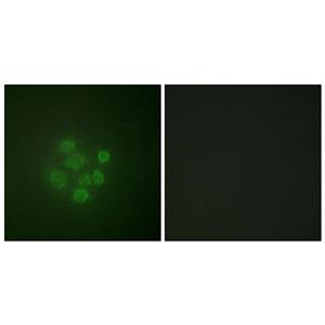 MDM2 (phospho Ser166)兔多抗,MDM2 (phospho Ser166) Rabbit Polyclonal Antibody