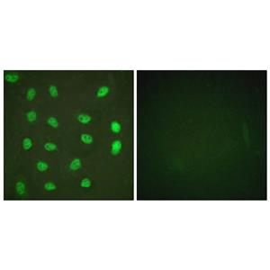 MEF-2 (phospho Ser408)兔多抗,MEF-2 (phospho Ser408) Rabbit Polyclonal Antibody