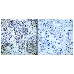 MEK-4 (phospho Thr261)兔多抗,MEK-4 (phospho Thr261) Rabbit Polyclonal Antibody