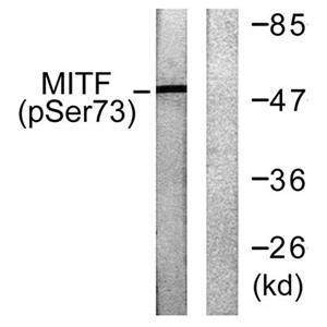 MITF (phospho Ser180)兔多抗,MITF (phospho Ser180) Rabbit Polyclonal Antibody