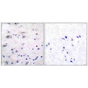 MOR-1 (phospho Ser375)兔多抗,MOR-1 (phospho Ser375) Rabbit Polyclonal Antibody