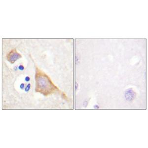 MOR-1 (phospho Ser375)兔多抗,MOR-1 (phospho Ser375) Rabbit Polyclonal Antibody