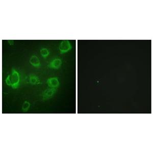 MRLC2 (phospho Ser18)兔多抗,MRLC2 (phospho Ser18) Rabbit Polyclonal Antibody