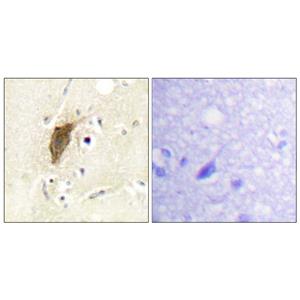 MRLC2 (phospho Ser18)兔多抗,MRLC2 (phospho Ser18) Rabbit Polyclonal Antibody