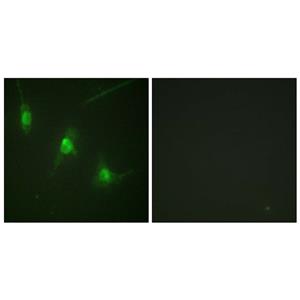 MSK1 (phospho Ser360)兔多抗,MSK1 (phospho Ser360) Rabbit Polyclonal Antibody