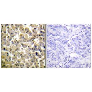 MSK1 (phospho Ser360)兔多抗,MSK1 (phospho Ser360) Rabbit Polyclonal Antibody