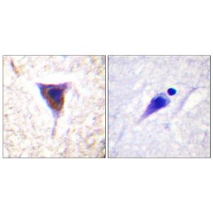 mTOR (phospho Ser2481)兔多抗,mTOR (phospho Ser2481) Rabbit Polyclonal Antibody