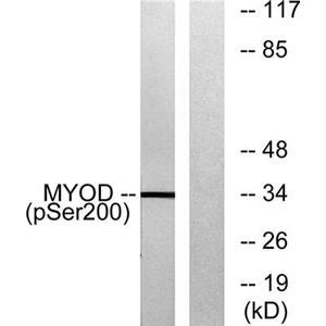 MyoD (phospho Ser200)兔多抗,MyoD (phospho Ser200) Rabbit Polyclonal Antibody