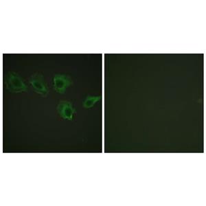 MYPT1 (phospho Thr696)兔多抗,MYPT1 (phospho Thr696) Rabbit Polyclonal Antibody