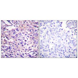 MYPT1 (phospho Thr696)兔多抗,MYPT1 (phospho Thr696) Rabbit Polyclonal Antibody