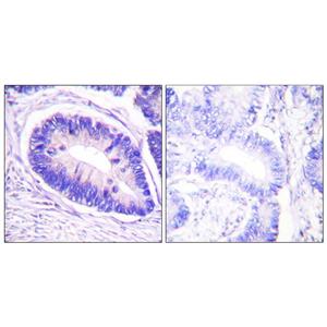 MYPT1 (phospho Thr853)兔多抗,MYPT1 (phospho Thr853) Rabbit Polyclonal Antibody