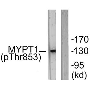 MYPT1 (phospho Thr853)兔多抗,MYPT1 (phospho Thr853) Rabbit Polyclonal Antibody